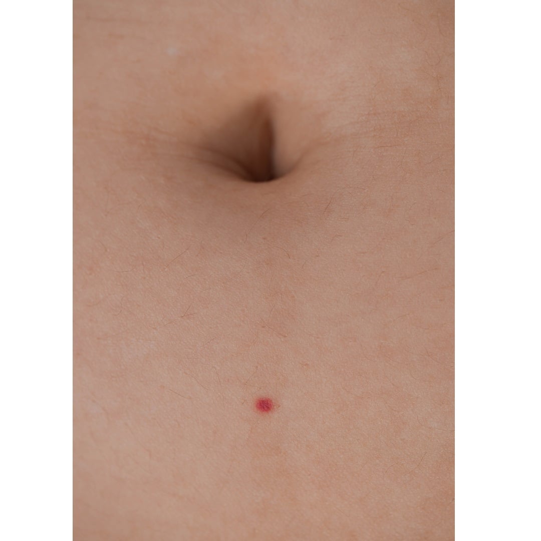 【先行予約｜12月初旬発送】 A Point Between Skin and the World / 1mm tattoo