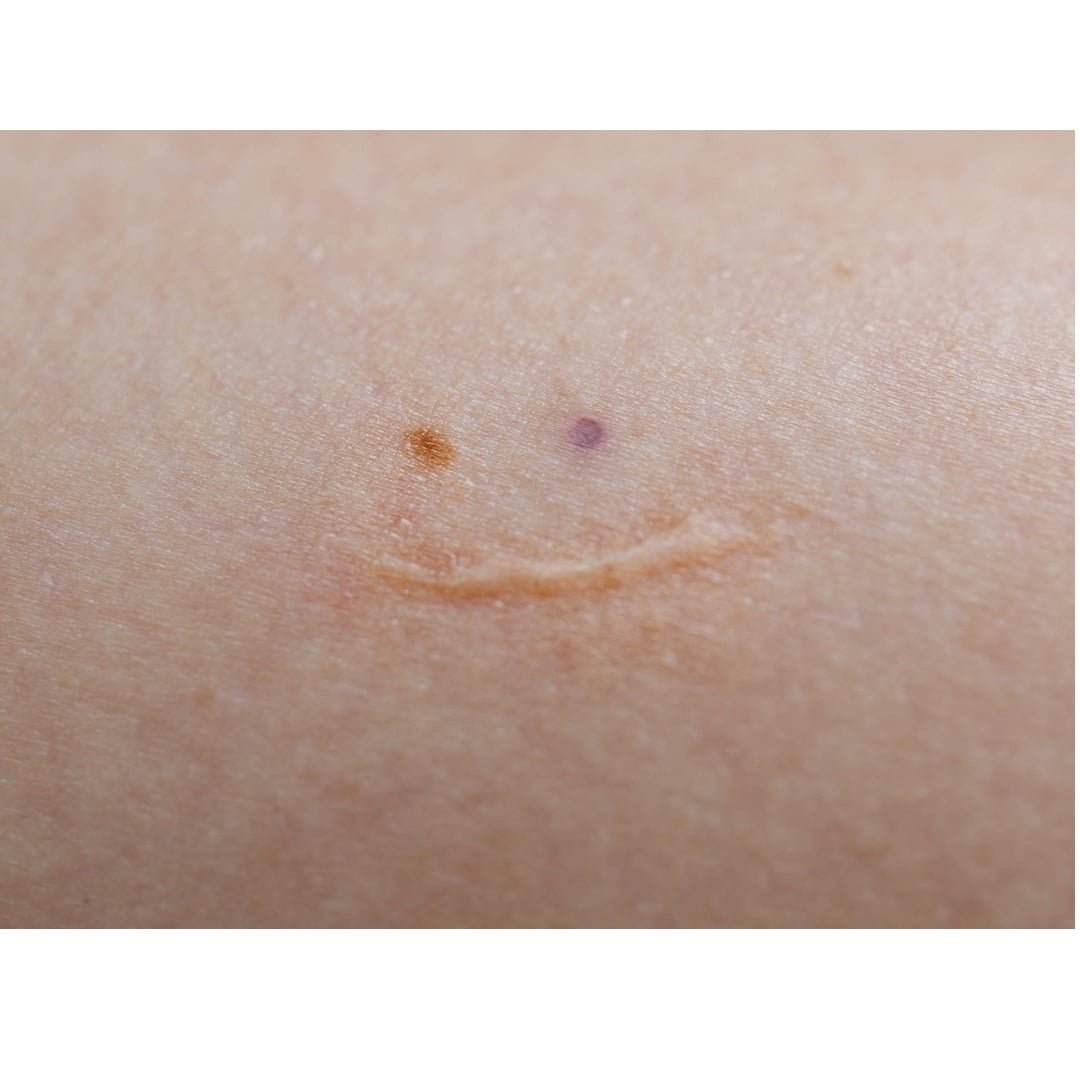 【先行予約｜12月初旬発送】 A Point Between Skin and the World / 1mm tattoo