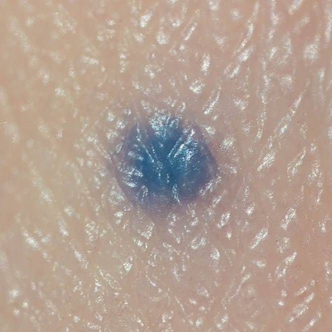 【先行予約｜12月初旬発送】 A Point Between Skin and the World / 1mm tattoo